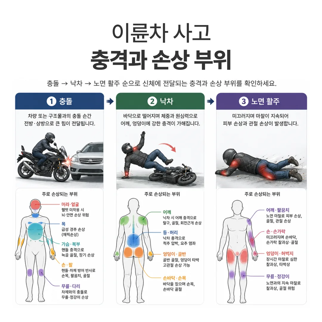 오토바이 사고에서 단계별로 손상이 집중되는 신체 부위 도해