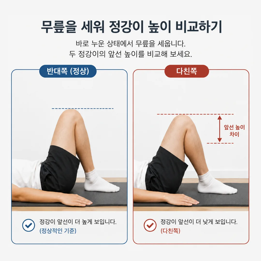 무릎을 세우고 옆에서 정강이 높이를 비교하는 자가 확인 자세