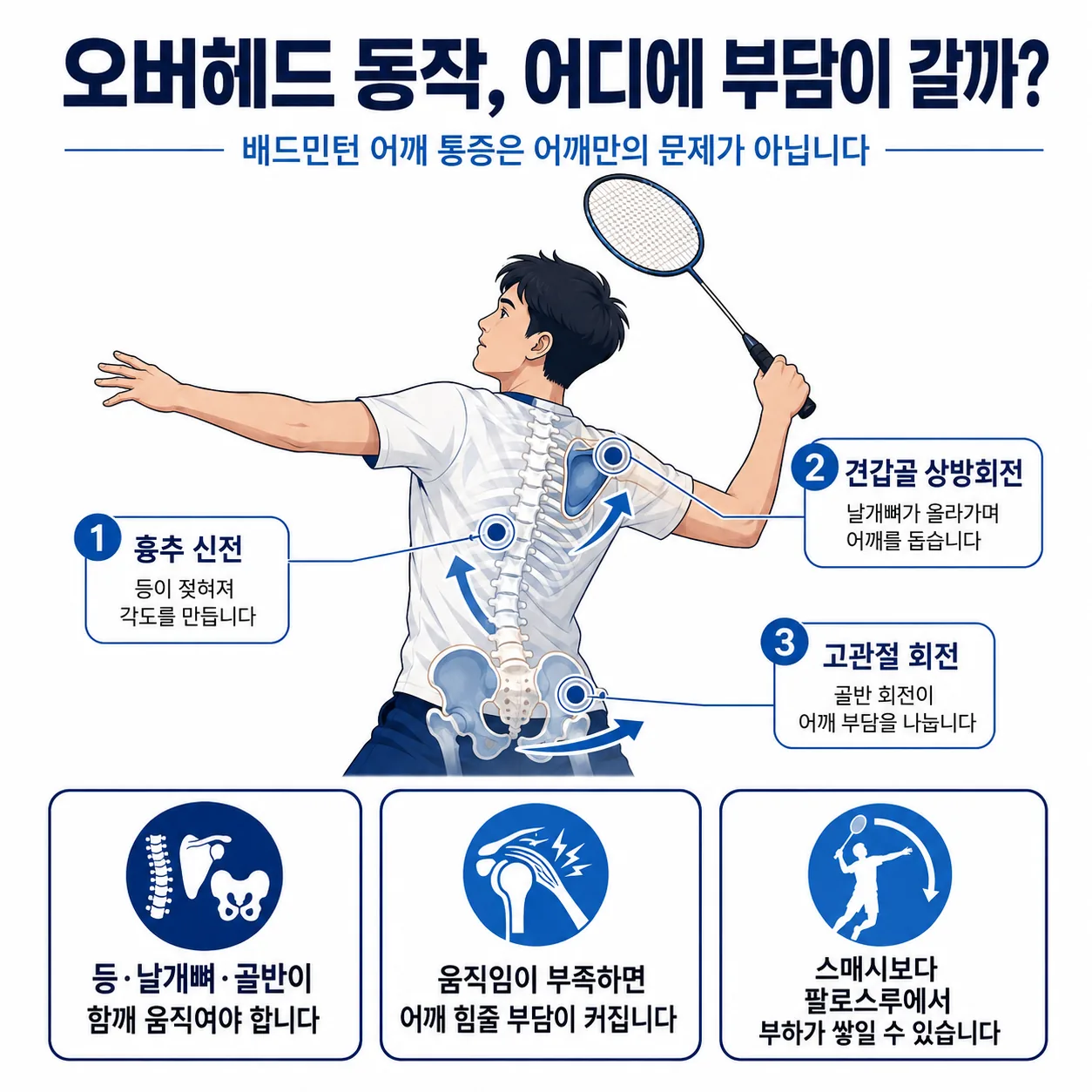 배드민턴 오버헤드 동작에서 어깨·등·날개뼈가 각도를 나누어 만드는 구조 설명 그림