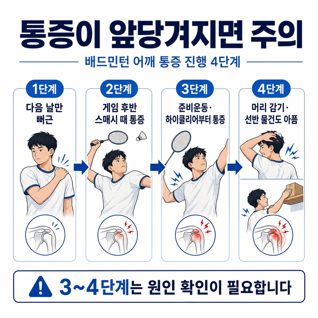 배드민턴 어깨 통증이 앞당겨지는 4단계 진행 타임라인