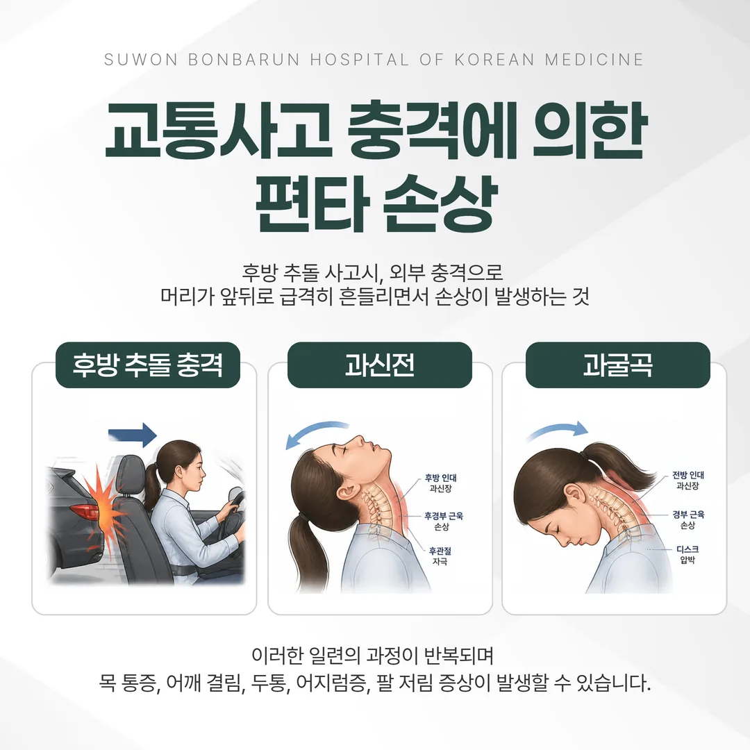 교통사고 편타성 손상 발생 원리 일러스트
