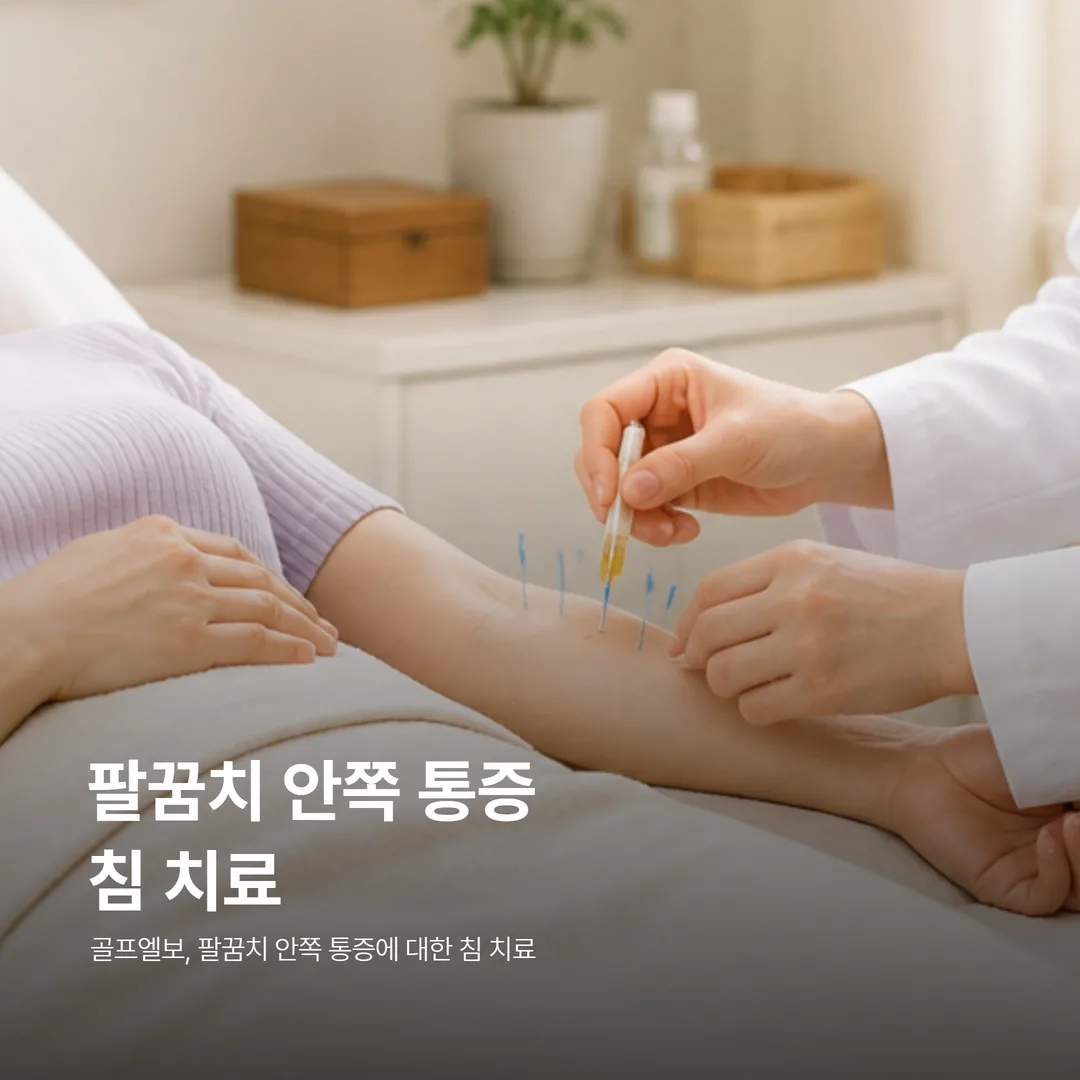 골프엘보 팔꿈치 안쪽 통증에 대한 침 치료 장면