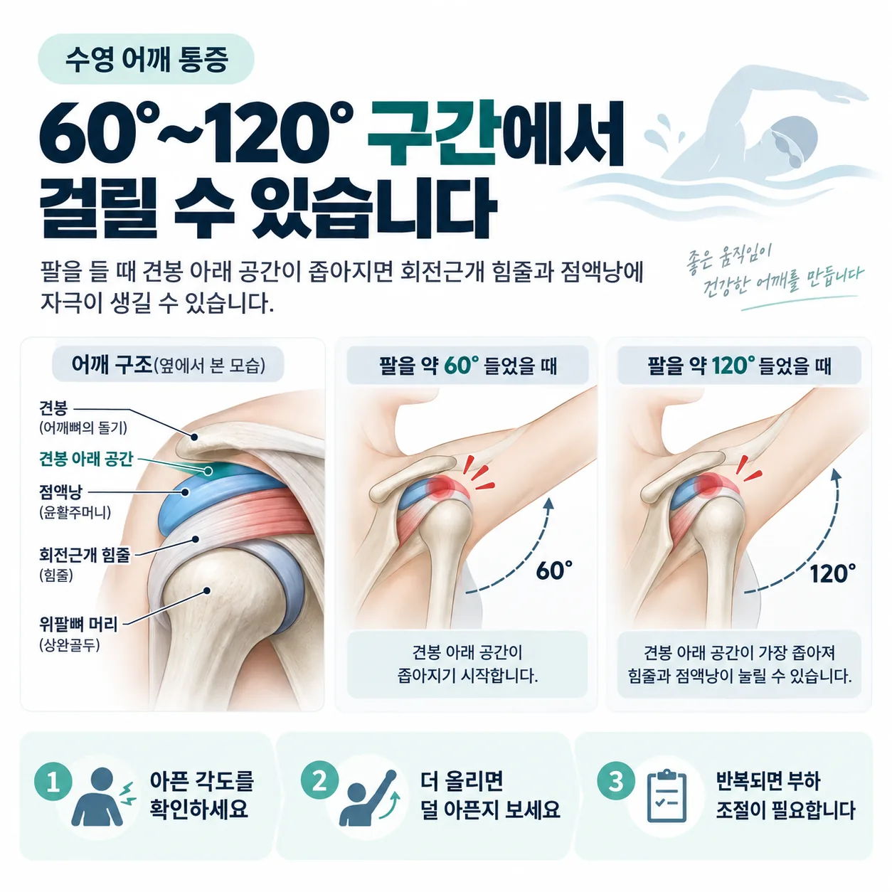 견봉 아래 공간과 회전근개 힘줄의 위치를 팔 거상 각도 60도와 120도 두 장면으로 나눈 개념도