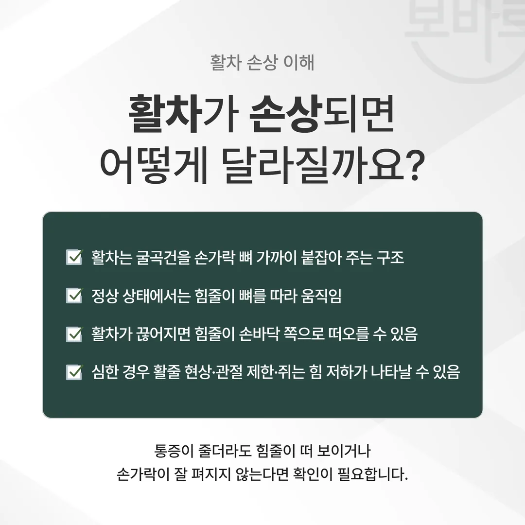 활차가 굴곡건을 붙들어 두는 정상 구조와 활줄 현상을 비교한 구조도