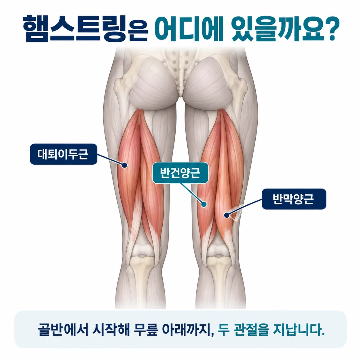 햄스트링 세 근육이 골반과 무릎 두 관절을 건너 이어지는 위치를 보여주는 해부 개념도