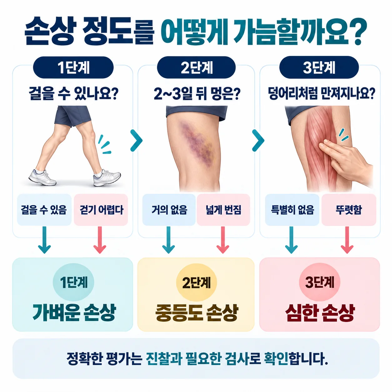 걷기 가능 여부와 멍 범위와 만져지는 소견 세 가지 관찰이 햄스트링 손상 1~3단계 판단으로 모이는 흐름도