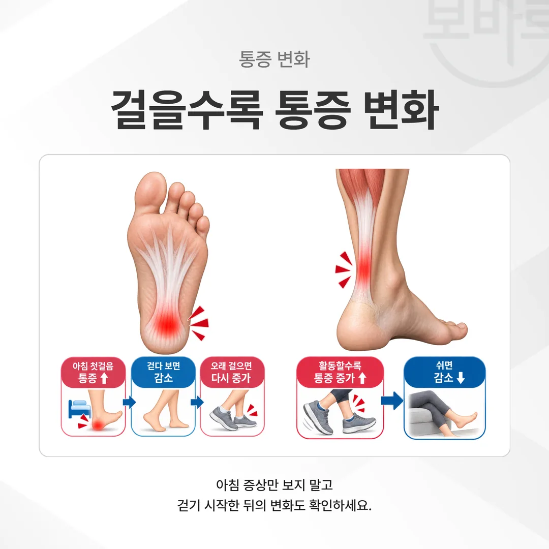 걷기 시작한 뒤 통증이 줄었다가 오래 걸으면 다시 오르는 곡선과, 활동하는 동안 계속 오르다가 쉬면 내려가는 곡선을 비교한 그래프